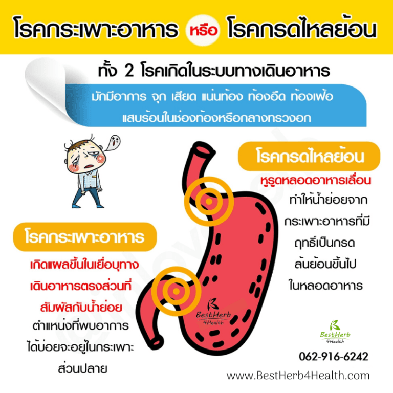 greencurmin curmamax กรีนเคอมิน เคอม่าแม็กซ์ สมุนไพรกรีนเคอมิน ขมิ้นชัน