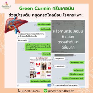 กรีนเคอมิน เคอม่าแม็กซ์ ขมิ้นชันสกัด กรดไหลย้อน โรคกระเพาะ ท้องอืด แน่นท้อง อาหารไม่ย่อย จุกเสียดท้อง แสบร้อนกลางอก