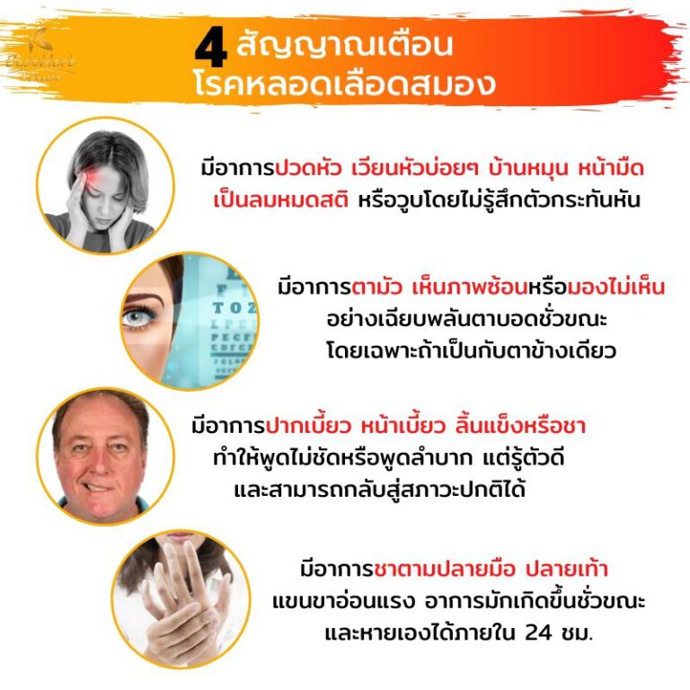 โอลิซ่าคิวเท็น โรคหลอดเลือดสมอง สัญญาณเตือน ปวดหัว ตามัว ปากเบี้ยว ชาปลายมือปลายเท้า
