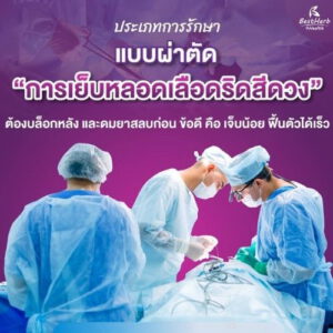ริดสีดวงทวารผ่าตัดแบบการเย็บหลอดเลือดริดสีดวง