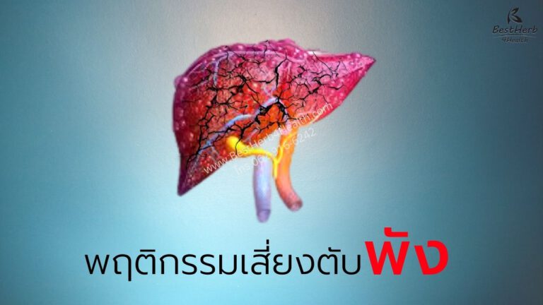 พฤติกรรมเสี่ยงตับพัง