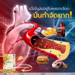 โอลิซาคิวเท็น สารสกัดจมูกข้าว มีแกมม่าออริซานอล 100 มล.ต่อแคปซูล ล้างไขมันในหลอดเลือด บำรุงสมอง และหัวใจ นอนหลับลึก หลับสนิท